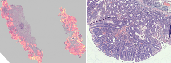 Use case from histopathology.